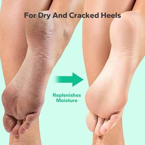Callus Remover Gel for Feet (8.45 fl.oz), Powerful Formulation Foot Callus Remover, Extra Strength Callus Remover, Callus Remover for Feet Gel, Calloused Feet Remover Gel for Home Use