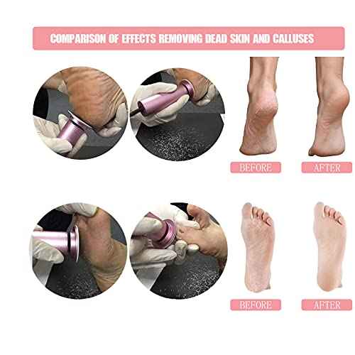 Electric Foot File Callus Remover Professional Foot File Pedicure Tools Adjustable Speed 60pcs Replacement Sandpaper disc Easy to Remove Cutin Dead Skin calluses(Black 60pcs)