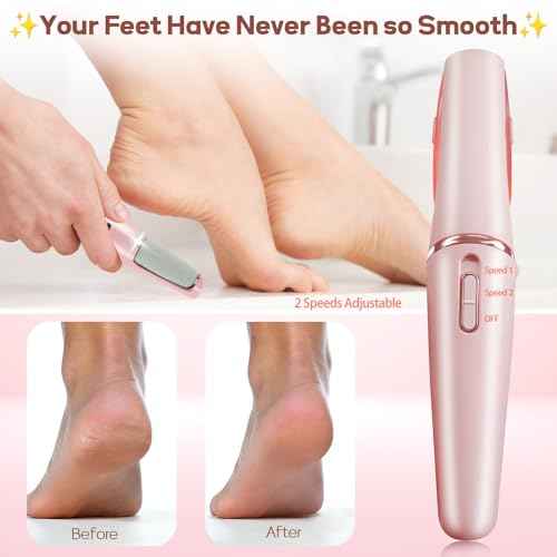 Callus Remover for Feet, ZABOUL Electric Foot Callus Remover Rechargeable Pedicure Tools Smooth Pedicure Wand Electronic Foot File, Feet Care for Removes Dry Hard & Dead Skin Ideal Gift