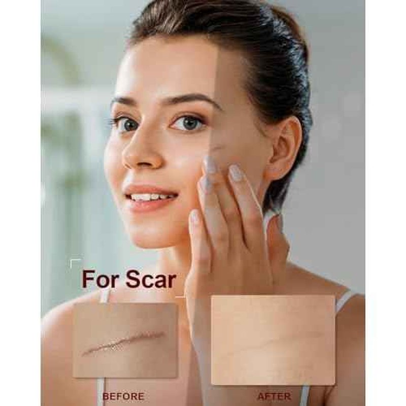 Organic Rosehip Seed Oil for Face,100 USDA Pure Rosehip Oils for Skin,Scars,Hair & Nails.2 fl Oz Cold Pressed Rose HIPS Oils for Skin Care, Anti-Aging, Scar Treatment, GUA SHA Massage Carrier Oil
