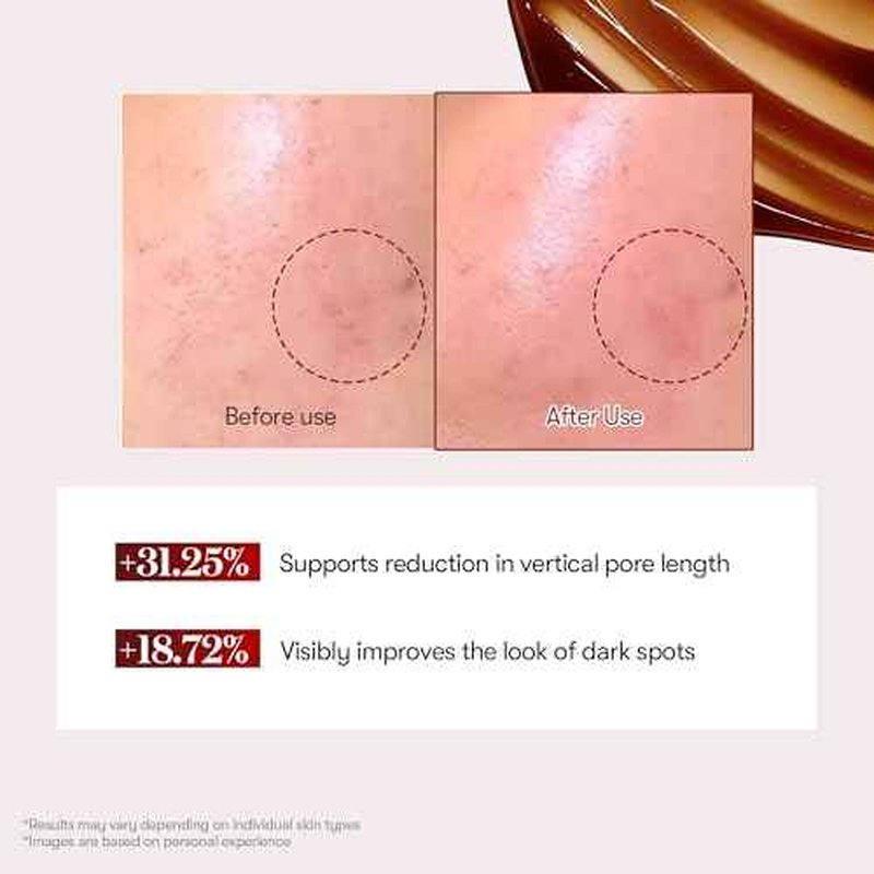 VT COSMETICS Red Booster Reedle Shot 100, Microneedling Serum with Dragon¡¯s Blood, Exosome, Soothing Relief Serum for Irritated, and Sun-Stressed Skin, Scalp Care, Korean Skincare 1.69 fl oz (50ml)