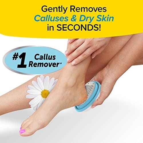PedEgg Classic Callus Remover, As Seen On TV, New Look, Safely & Painlessly Remove Tough Calluses Dry Skin to Reveal Smooth Soft Feet, 135 Precision Micro-Blades, Traps Shavings