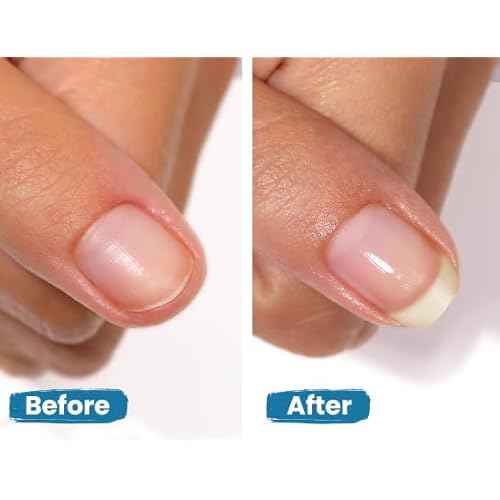 LONDONTOWN Get Strong Nail Hardener - Nail Strengthener Growth Treatment for Damaged Nails, Conditioning Nail Care for Long Healthy Nails, .40fl oz