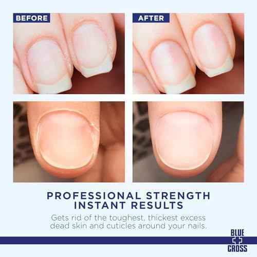 Cuticle Remover & Softener Liquid for Nails ? Blue Cross Professional Nail Care with Lanolin, Hydrating Treatment for Dry Cuticles & Hangnails, Made in USA, 6oz