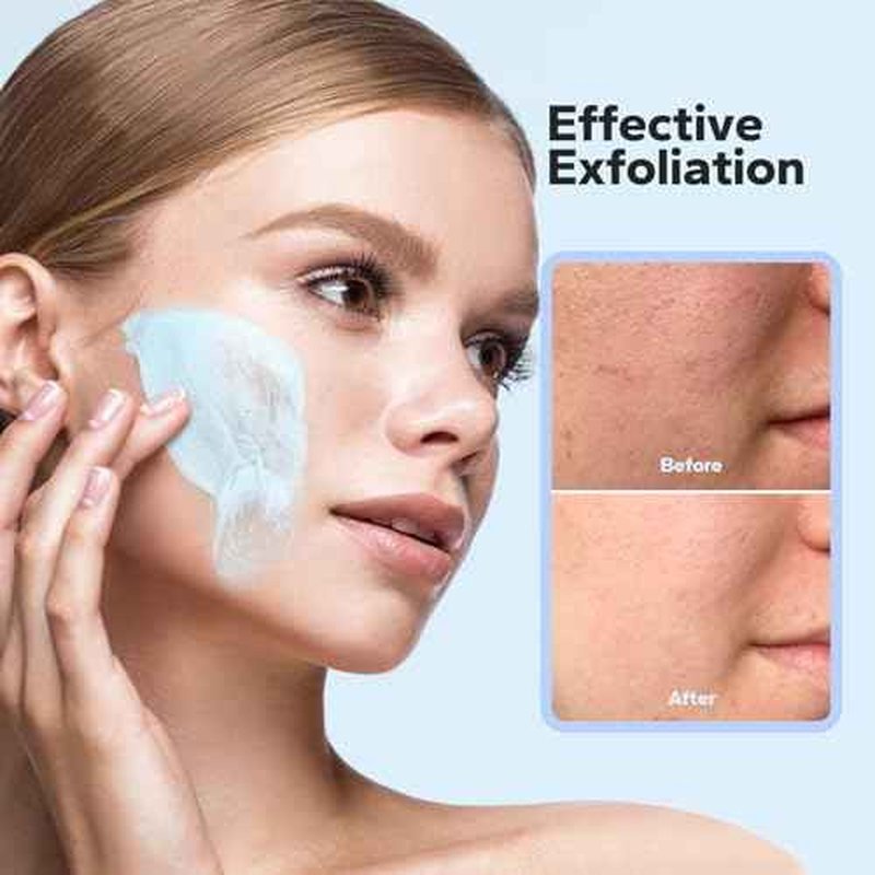 Microdermabrasion Face Scrub (4.23 Oz), Exfoliating Face Wash, Facial Scrub Exfoliator with Natural Pumice, Peptides & Botanical Extracts, Facial Exfoliator for Smooth and Refreshed Skin