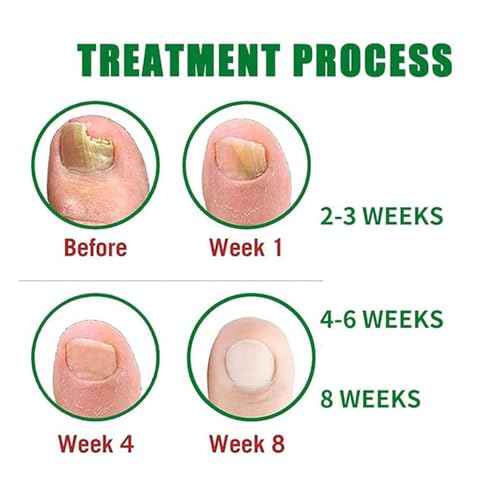Treatment Gel, Nail Growth Serum for Repair & Strengthener, Multi-Purpose Nail Repair Oil Serum, Foot Care Cream(1pcs)