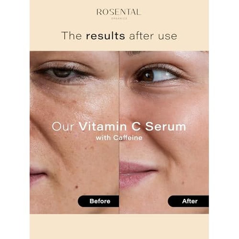 Organics Vitamin C Serum with Caffeine (30ml) ? Hydrating Face Serum for Dark Spots, Acne Scars, Wrinkles ? Brightening & Anti-Aging Facial Care ? Natural Cosmetics ? Made in Germany