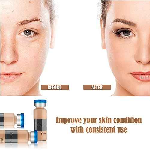 BB Facial Glow Starter Kit Facial Pigment Serum Treatment Kit,Anti-Aging Serum Pigments Set for Micro-needling Skin Treatment 10 Vials 5ml Hyaluronic Acid Ampoule foundation Essence Skin