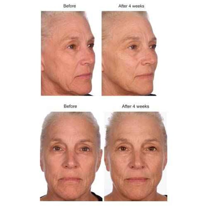 Serious Skincare - Black Pearl Deep Wrinkle Decrease Face Serum - Repair Deep Lines & Wrinkles - Increases Skin Hydration & Elasticity - Radiance Boosting for Luminous Glowing Skin 1 Fl. Oz.