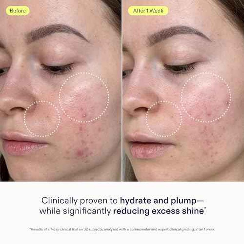 Skinfix Skin Barrier Restoring Gel Cream - 1.7 oz Refill - Non-Greasy Moisturizer for Normal to Combination Skin - Hydrates, Plumps & Smooths - Non-Comedogenic, Fragrance Free, Vegan, Cruelty Free