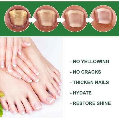 Ginger Nail Treatment Serum Oil, Nail Regrowth Serum, Nutrient Oil for Nail Cuticle Repairing, Promoting Regrowth, Strengthening, Plant-Based Formula with File Tool