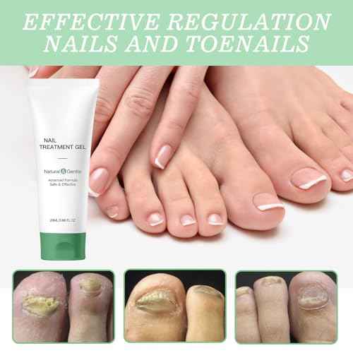 Treatment Gel, Nail Growth Serum for Repair & Strengthener, Multi-Purpose Nail Repair Oil Serum, Foot Care Cream(1pcs)