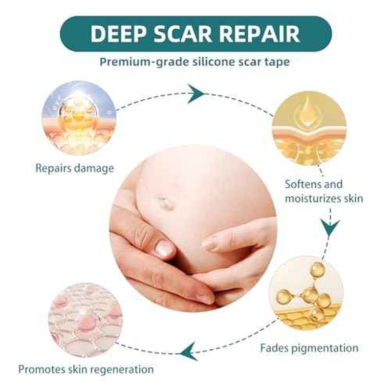 Silicone Scar Gel Sheets: Medical Grade Scar Tape for C Section Surgical Tummy Tuck Keloid Treatment?Scar Removal for Face and Skin