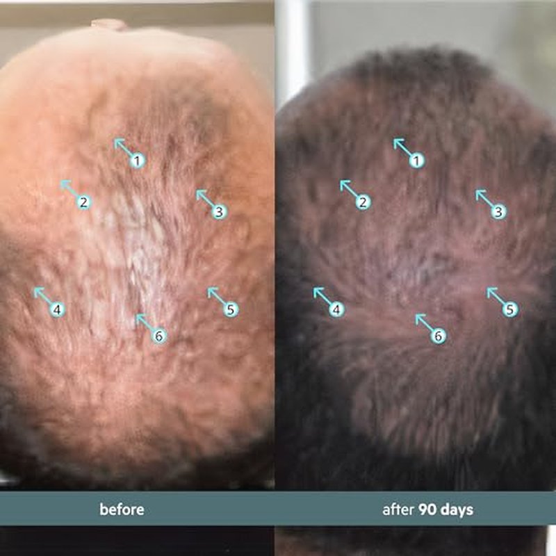 DS Labs Spectral Booster (formerly Spectral.F7) Hair Density Serum, 60mL - Non-Greasy, Leave-In, Supports Fuller, Thicker, Looking Hair, with Astressin-B Peptide & Copper Peptides, Water-Based