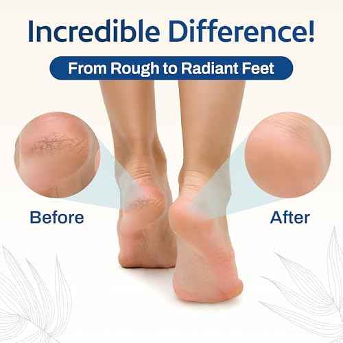 HartFelt Pedicure Exfoliation Beauty Box with 6 Exfoliating Foot Scrubber Bath Sponges & 2 Magic Pumice Stone for Feet Callus Remover | Gentle Sponge Pad & Foot Scrubbing Stone for Deep Cleansing