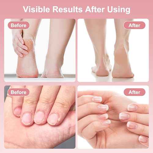 Electric Foot Callus Remover, 2 in 1 Rechargeable Foot File for Feet & Nails, 9 Speed Controller Callus Remover with Replaceable Sandpaper, Cordless Pedicure Tools for Dead Skin and Calluses (Pink)