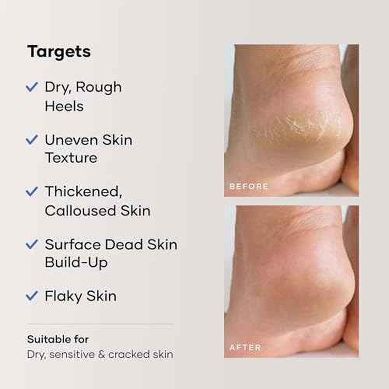 Cureskin Foot Care Cream for Cracked Heels | Repairs, Softens, and Exfoliates | Foot Cream for Women and Men, 50 g (Pack of 1)