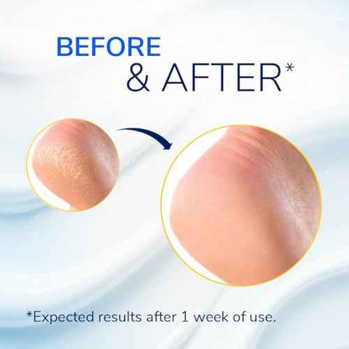 Dr. Scholl's Severe Cracked Heel Repair Restoring Balm 2.5oz, with 25% Urea for Dry, Cracked Feet, Heals and Moisturizes for Healthy Feet
