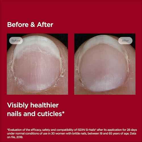 ISDIN Si-Nails - Fast Absorbing Nail Strengthening and Hardening Serum for Nail Durability in Thin Nails, made with Cationic Hyaluronic Acid 0.08 FL OZ