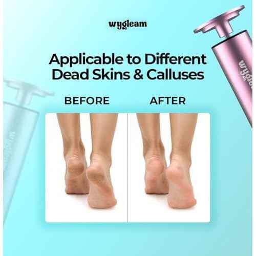 2-in-1 Electric Callus Remover and Nail File Drill Kit for Flawless Feet & Nails - 3 Speeds, Rechargeable, Professional at-Home Pedicure & Manicure Tool