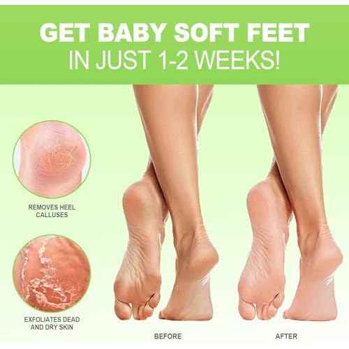 JVR Foot Peel Mask - 3 Pairs - Exfoliating Peeling Callus Remover, Repairs Cracked Heels & Dry Skin, for Smoother and Softer Feet (Aloe Vera)