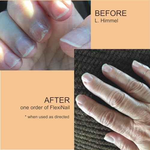 Penetrating Fingernail Conditioner and Strengthener to repair and then maintain weak and peeling or brittle and splitting nails