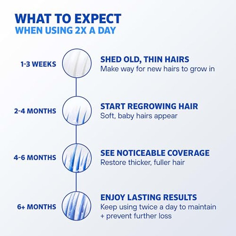 Men¡¯s Rogaine 5% Minoxidil for Men Foam, Clinically Proven Regrowth for Thinning Hair, Topical Hair Loss Treatment, Unscented Topical Aerosol, Results in 8?16 Weeks, 3-Month Supply, 3 x 2.11 oz