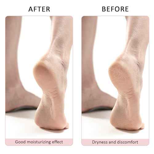 3 Pairs Aloe Socks, Aloe Infused Socks for Women, Fuzzy Moisturizing Socks, Spa Socks for Men, Lotion Socks Heel Socks for Dry Cracked Feet Women, Gel Socks Sleep Socks