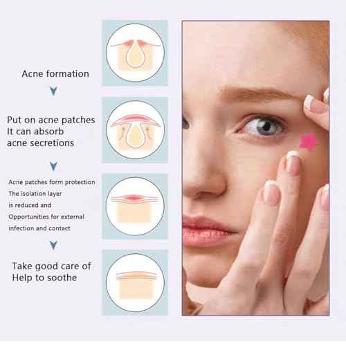 Star Pimple Patches for Face w/Hydrocolloid, Salicylic Acid &Tea essential oil 240 Patches, Hydrocolloid Acne Patch,-03