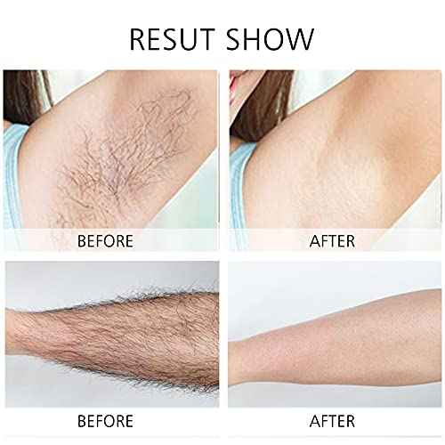 Women's Electric Shaver Replacement Heads : 5 Legs Hair Removal Razor Replacement Heads 4D Floating Heads Replacement Blades for Women