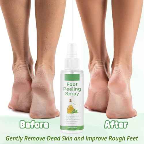 Foot Peeling Spray, Tea Tree Foot Exfoliator Spray, Vegan Botanicals, Moisturizing & Smooth Feet Skin, Gently Exfoliates Away Rough, Dry Skin, 4.06fl.oz/120ml