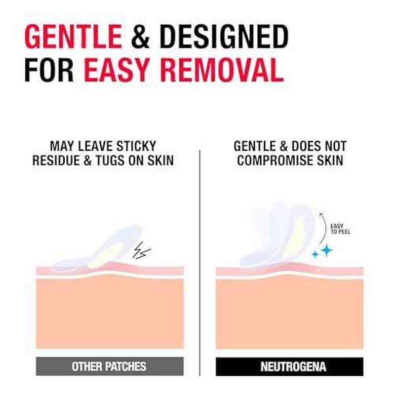 Neutrogena Sensitive Skin Blemish Patches, Acne Patches for Sensitive Skin, Hydrocolloid Treatment Visibly Shrinks Pimples Overnight, 2 Sizes, 30 Count