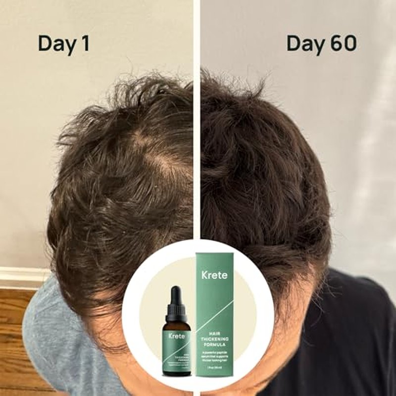 Krete Hair Thickening Formula ? Supports Thicker-Looking Hair for Men ? 1 fl oz