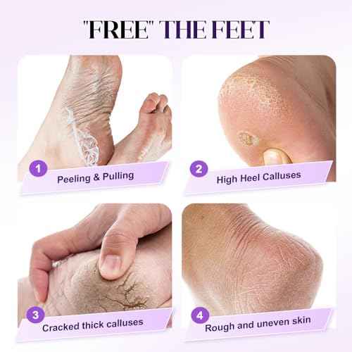 Foot Pumice Stone with Stripes to Increase Friction, 2025 Upgraded Professional Pedicure Foot Pumice Stone for Feet Hard Skin Callus Remover and Scrubber, Durable Exfoliating Stone for Spa Pedicure