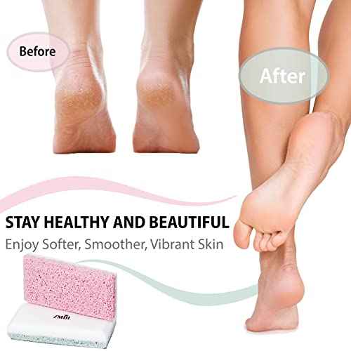 Siliglass Pumice Stone Callus Remover for Feet, Elbows, Hands, and Knees, Spain Made - 2 in 1 Pedicure Exfoliator and Scrubber for Rough, Hard Skin (1 Pack)
