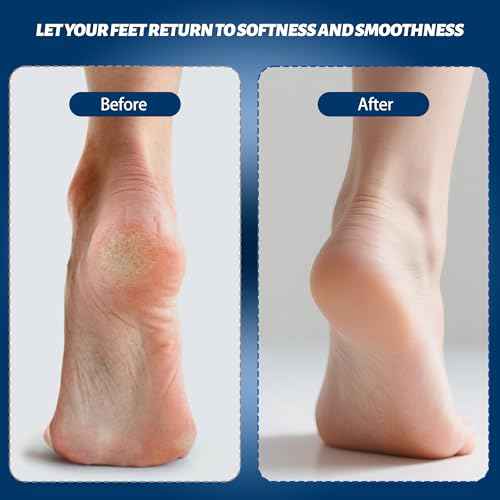 Electric Feet Foot Callus Remover Equipped with A Vacuum System Foot Scrubber 17 in 1 Professional Foot Care Tool Ipx6 Waterproof Rating for Removing Hard Cracks Dryness and Dead Skin (Black)