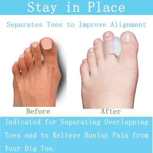 Pack of 12 Gel Toe Separator, (1/4" Thick) Big Toe Spacers, Single Loop Toe Spreader for Bunions, Overlapping Toe, Corrector and Spacer (Clear)