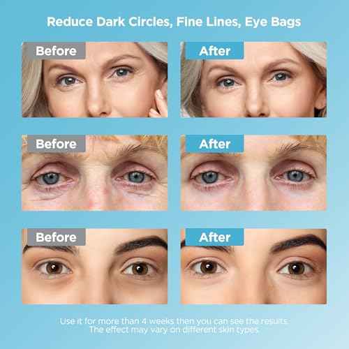 Dongyu Caffeine Eye Cream Set: Eye Serum Kit for Dark Circles Puffiness - Self Care Gifts for Women Birthday Gifts for Her