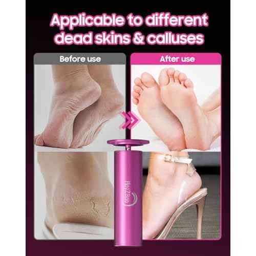 Electric Foot Callus Remover - Electric Callus Remover for Feet,Adjustable Speed Foot Scrubber with 60 Pcs Sandpaper Discs,Professional Pedicure Tool for Dead Skin and Calluses - Matte Purple