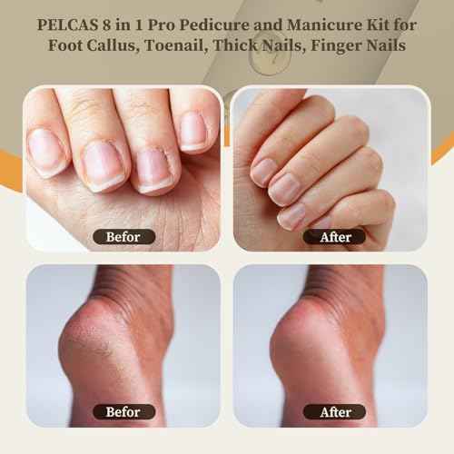 PELCAS 8 in 1 Cordless Nail Drill, Electric Nail Filer 5 Speeds Manicure & Pedicure Kit with LED Light, Electric Foot Callus Remover for Foot Callus, Toenail, Thick Nails, Finger Nails Golden