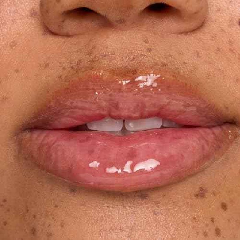 ColourPop Limited Edition Fresh Kiss Glossy Lip Balm - Hydrating Lip Care Enriched with Peptides, Hyaluronic Acid, Shea Butter & Vitamin E for an Ultra-Cushiony Formula - Candy Cane (0.49 oz)