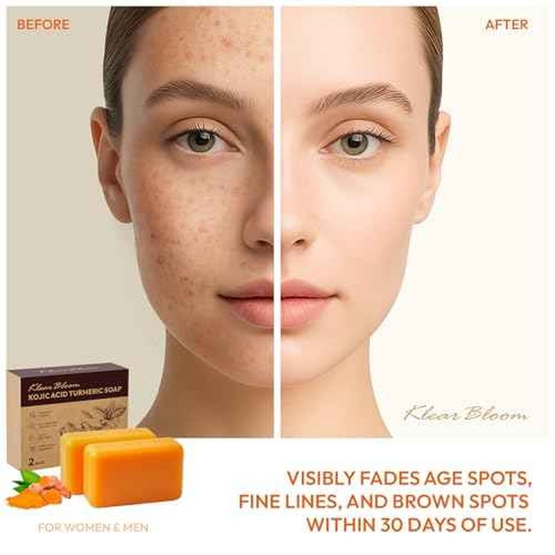Kojic Acid Soap, Turmeric Soap Bar for Dark Spots Brightening & Moisturizing with Collagen, Vitamin E, Retinol, Hyaluronic Acid, Shea Butter, Paraben & Sulfate-Free 105g x 2 Bars
