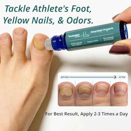 Swissklip Medi-Care Toenail Stick I KlearNail Treatment | Natural Solution for Healthy Nails I Suitable For Foot, Toe, and Fingernail I For Brittle Toenails ? 10ml / 0.3 Fl. Oz. Pack 2 - Made in USA
