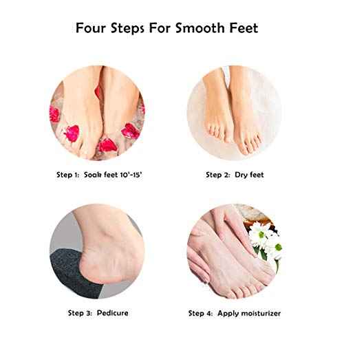 Natural Lava Pumice Stone, Pedicure Tool, Hard Callus Dead Skin Remover, Foot File for Exfoliation & Fine Foot Scrubber for Smoothing & Softening Skin¡¦