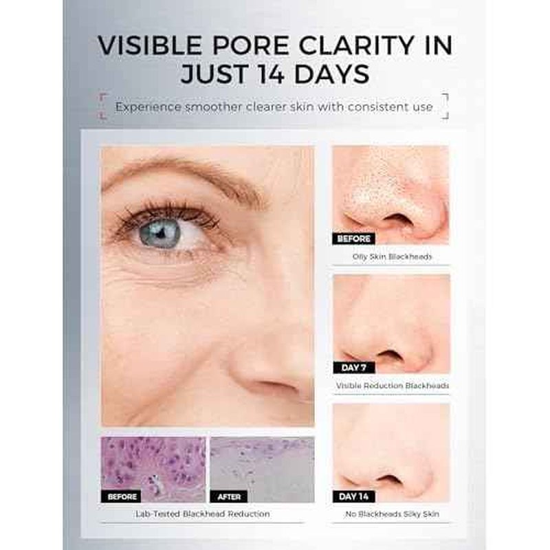 Clay Mask for Face Sensitive Skin: Triple Mud Formula, Deep Pore Cleansing, Hydrating, Oil Balancing, Smoothing, Pore Refining ? 3.88 Oz