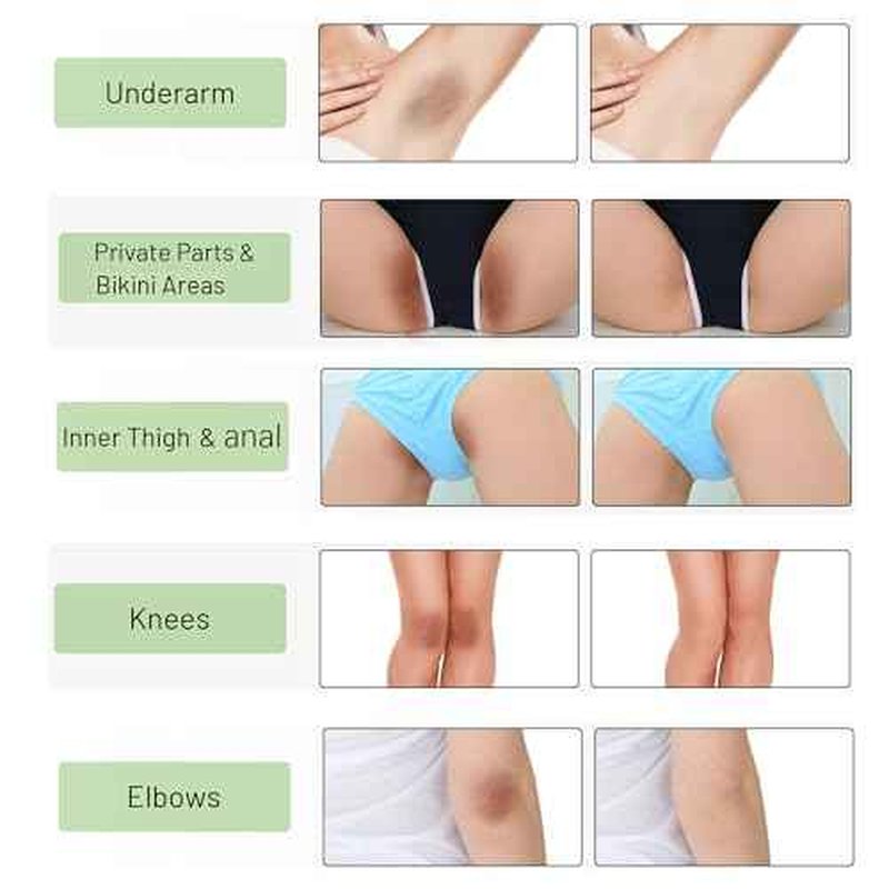 Skin Bleaching Cream for Intimate Areas & Body, Vitamin C Whitening for Underarms, Knees, Elbows, Inner Thighs, Bikini Line ? Sensitive Skin Whitening Lightening Cream for Women