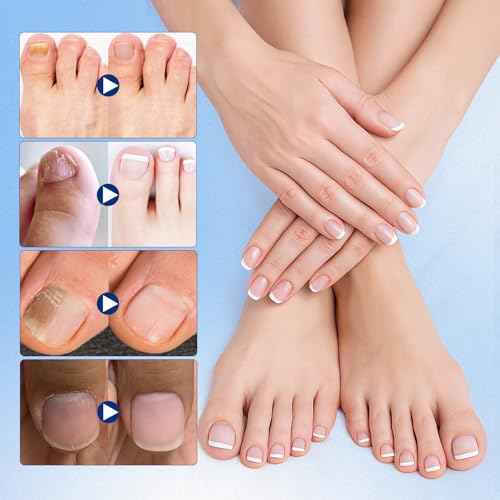 Toenail Fungus Treatment Extra Strength - 21 Pcs Fungal Nail Patches, 8-Hour Firm Adhesion, Nail Repair for Damaged Nails, Overnight Renewal for Men and Women