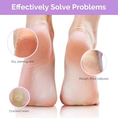 MelodySusie Hydrating Foot Mask Intensely Moisturizes Repairs for Dry,Cracked Feet,Callus,Suitable for home salon use Lavender Scented Pack of 3