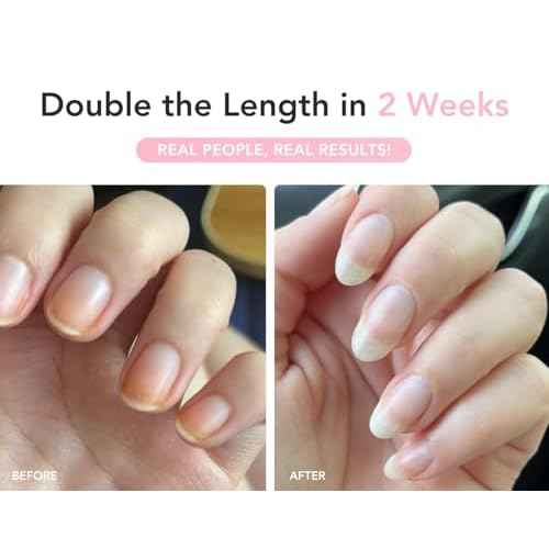 Liaison UltraGrow Nail Serum for Growth and Strength with Keratin Complex, Olive Oil & Vitamin E | Dermatologist-Tested to Support Weak, Brittle, Splitting Nails