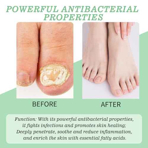 Treatment Gel, Nail Growth Serum for Repair & Strengthener, Multi-Purpose Nail Repair Oil Serum, Foot Care Cream(1pcs)